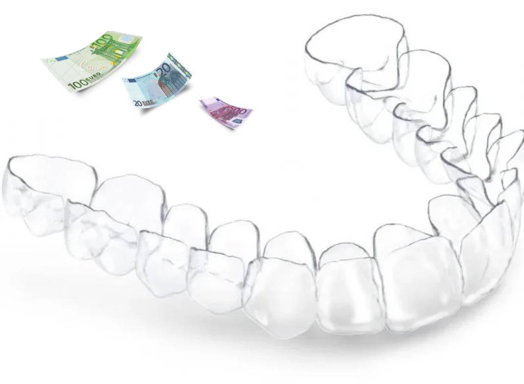 Comment enlever un double menton prix Marseille 13008