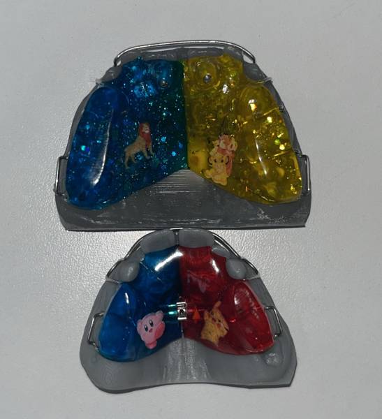 Comment aligner les dents supérieures et inférieures de votre enfant ? Le docteur Madar, orthodontiste, répond à vos questions