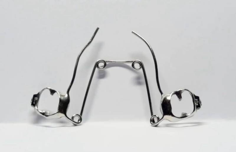 Correction d’un palais trop étroit avec Quad Helix pour enfants à Marseille Saint-Barnabé 13012