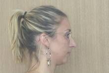 Notre zone d'activité pour ce service Orthodontiste pour traitement du sourire asymétrique