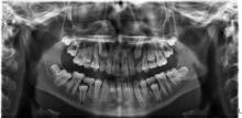 Notre zone d'activité pour ce service Correction de la dentition pour une occlusion dentaire parfaite