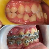 Nos prestations sur le secteur de Marseille 13008